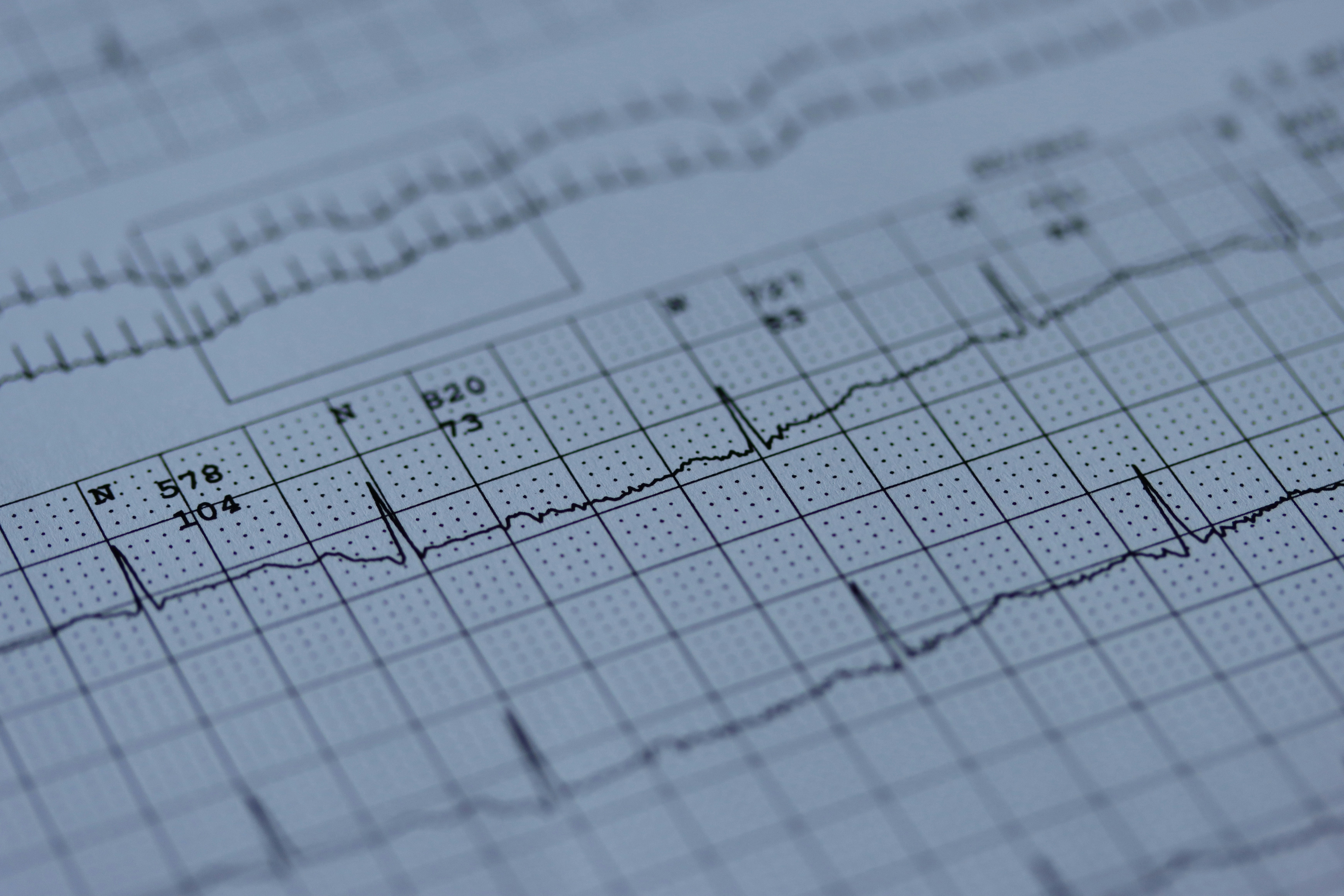 Advanced cardiac monitoring with Zio iRhythm